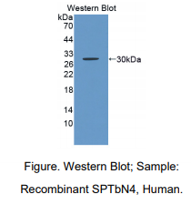 人非红细胞血影蛋白β4(SPTbN4)多克隆抗体