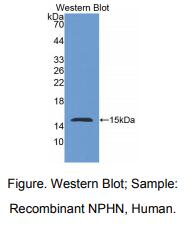 人肾足蛋白(NPHN)多克隆抗体