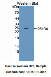 人热休克蛋白β7(HSPb7)多克隆抗体